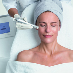 Microneedling bei Medically Beauty